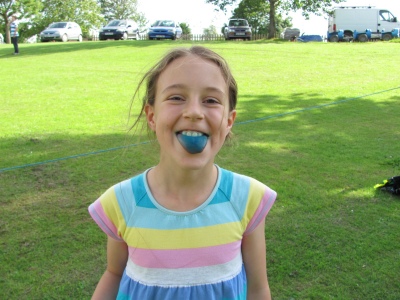 Bluetongue